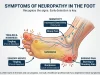 Neuropathy in the Foot Symptoms: Signs You Shouldn’t Ignore Neuropathy in the Foot Symptoms Signs You Shouldn't Ignore