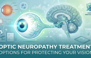 Optic Neuropathy Treatment: Options for Protecting Your Vision Optic Neuropathy Treatment Options for Protecting Your Vision